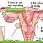 Ảnh đại diện bài viết