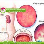 Ảnh đại diện bài viết