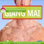 Ảnh đại diện bài viết
