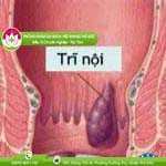 Ảnh đại diện bài viết