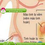 Ảnh đại diện bài viết