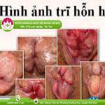 Ảnh đại diện bài viết