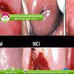 Ảnh đại diện bài viết