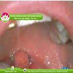 Ảnh đại diện bài viết