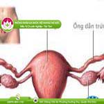 Ảnh đại diện bài viết