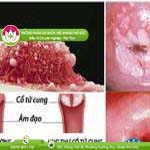 Ảnh đại diện bài viết
