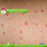 Ảnh đại diện bài viết