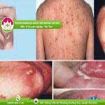 Ảnh đại diện bài viết