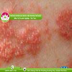 Ảnh đại diện bài viết