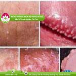 Ảnh đại diện bài viết